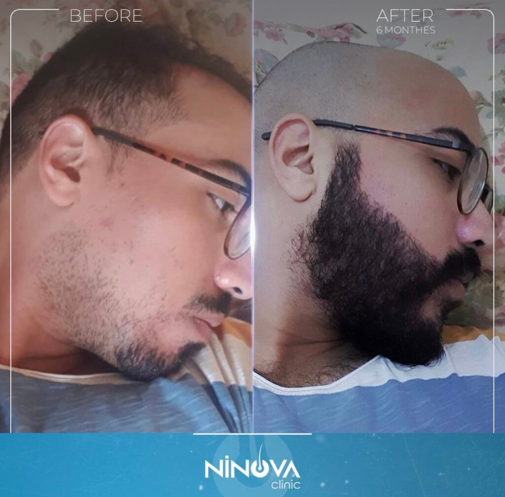 5BDEB733-B440-43BE-973B-19F2BCD4AEA3